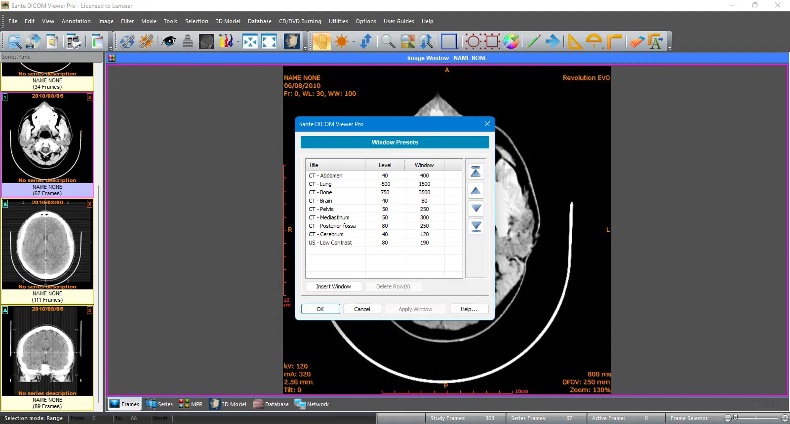 Инсталляция и активация