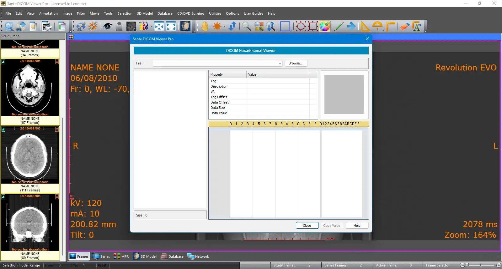 Инсталляция и активация