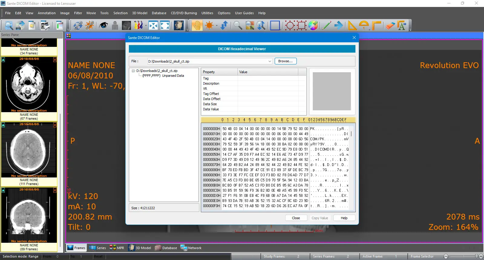 Инсталляция и активация