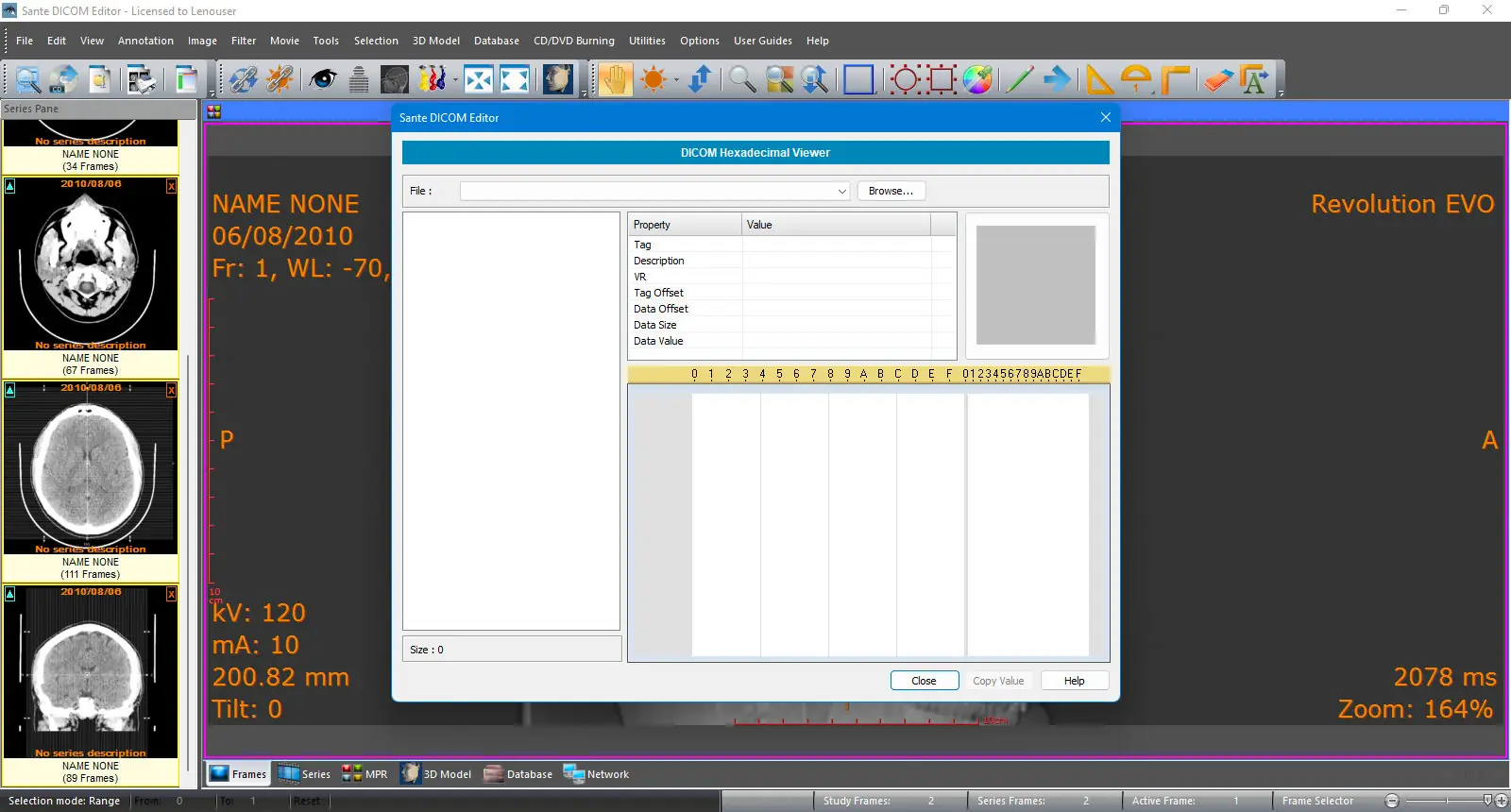 Инсталляция и активация
